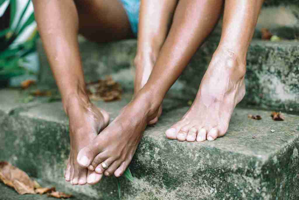 ugly feet pictures